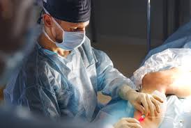 chirurgia vascolare