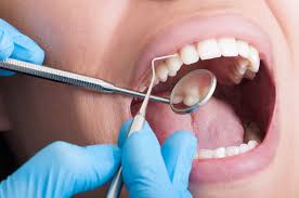parodontologia i sintomi
